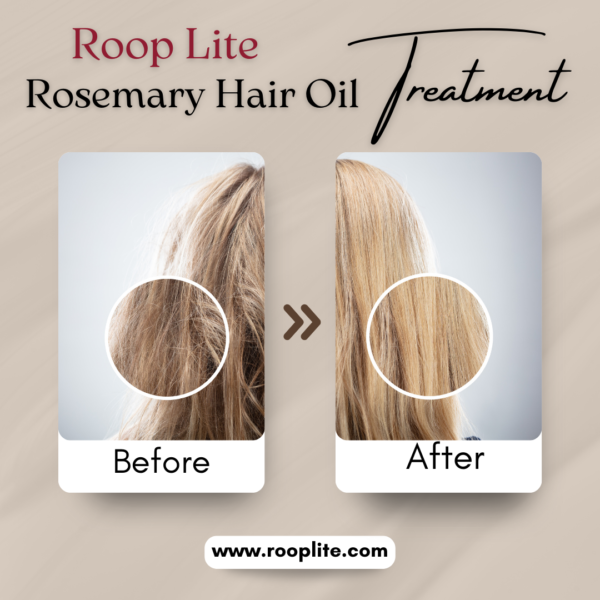 Roop Lite Rosemary Hair Oil 100ML